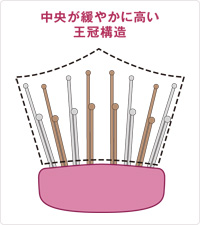 特許取得の頭皮密着設計